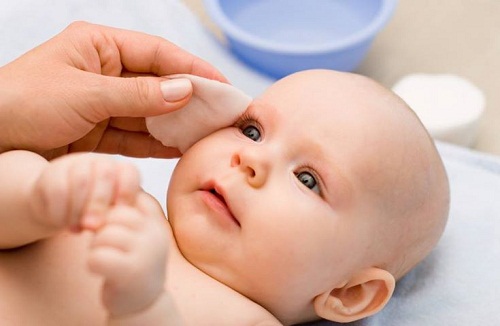 Trẻ sơ sinh bị đổ ghèn mắt phải làm sao?