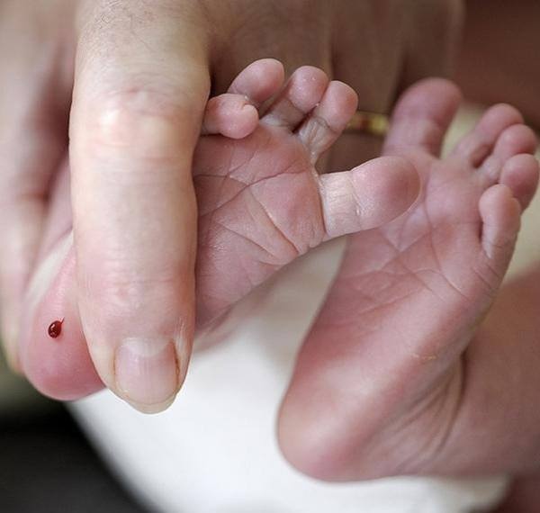 Lấy máu gót chân cho trẻ sơ sinh có quan trọng không?