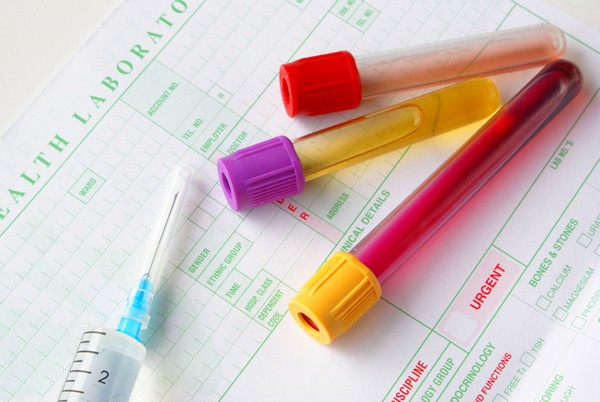 Kết quả xét nghiệm máu & nước tiểu cho biết điều gì?